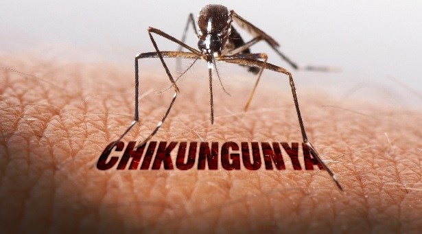 Resultado de imagem para chikungunya